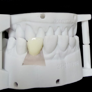 Dental implant manufacturing