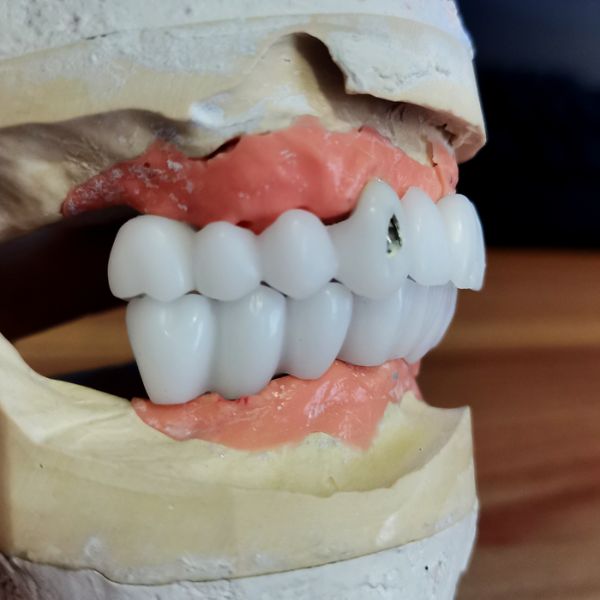 Dental implant service